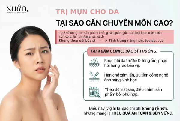 tại sao trị mụn cần bác sĩ