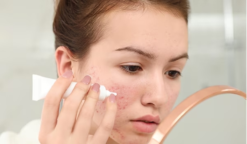 Bôi Thoa Tại Nhà