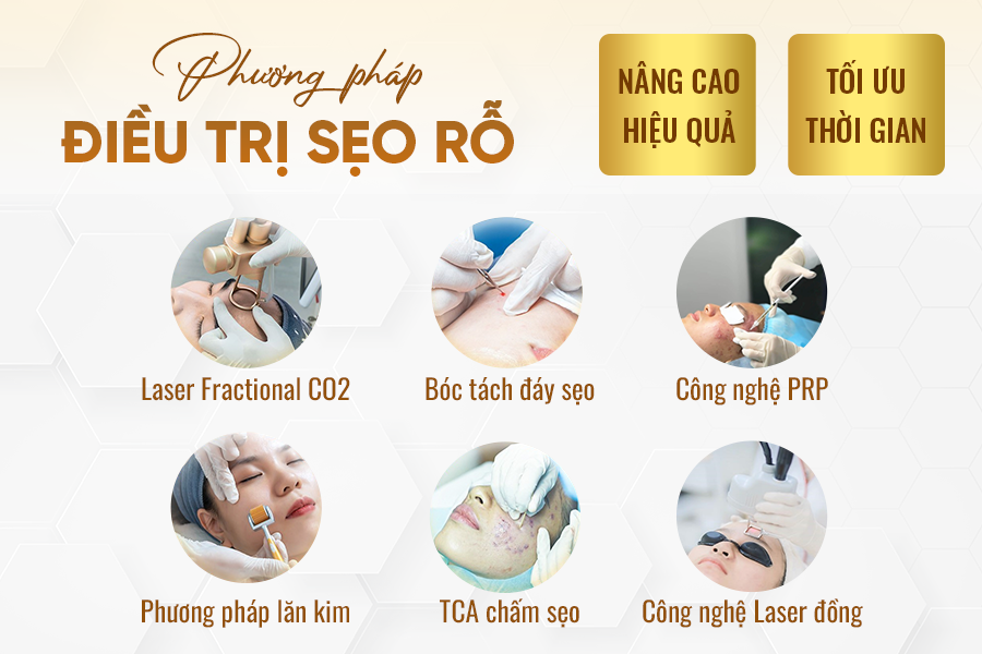 các phương pháp trị sẹo rỗ