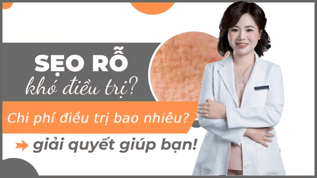 chi phí trị sẹo rỗ