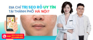 dieu-tri-seo-ro-o-ha-noi