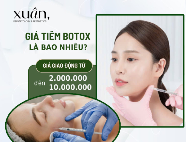 Giá tiêm botox bao nhiêu