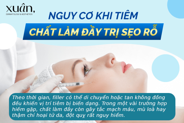 nguy cơ tiêm chất làm đầy trị sẹo rỗ