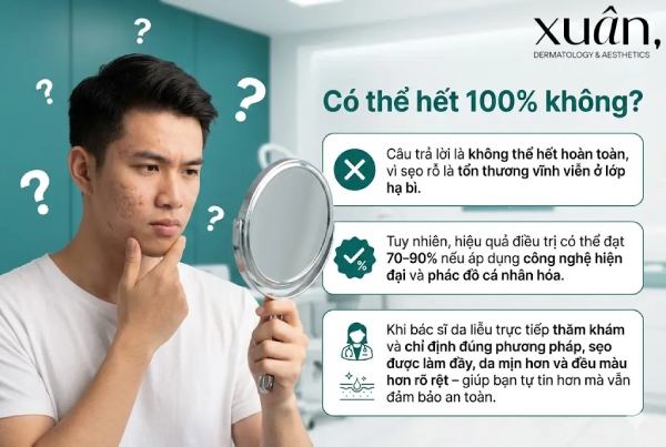 sẹo rỗ có hết 100% không