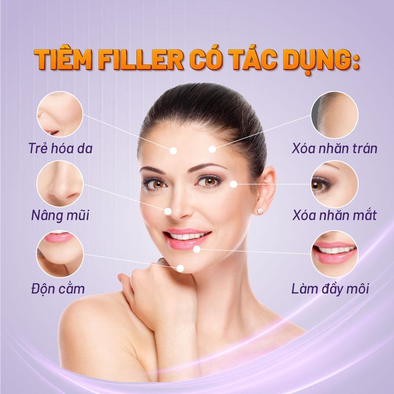 tác dụng tiêm filler
