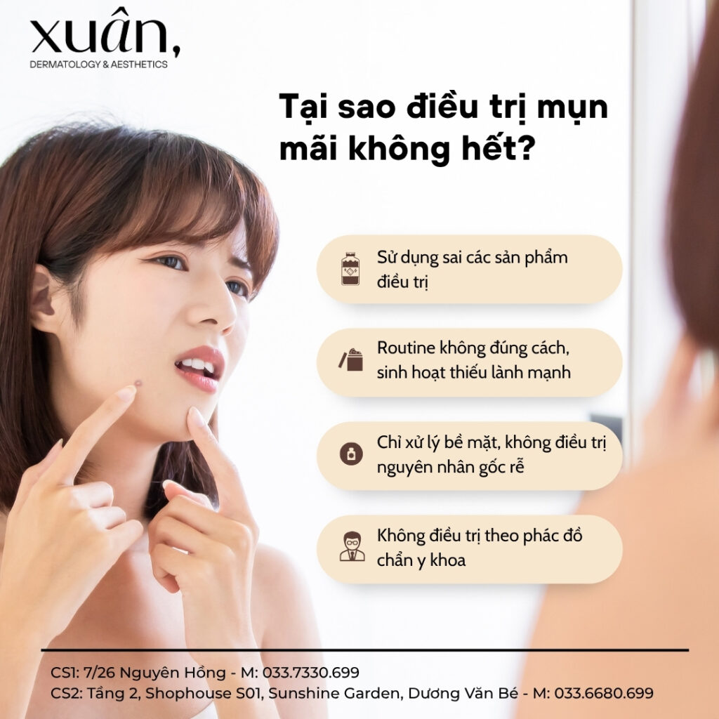 tại sao trị mụn mãi không khỏi