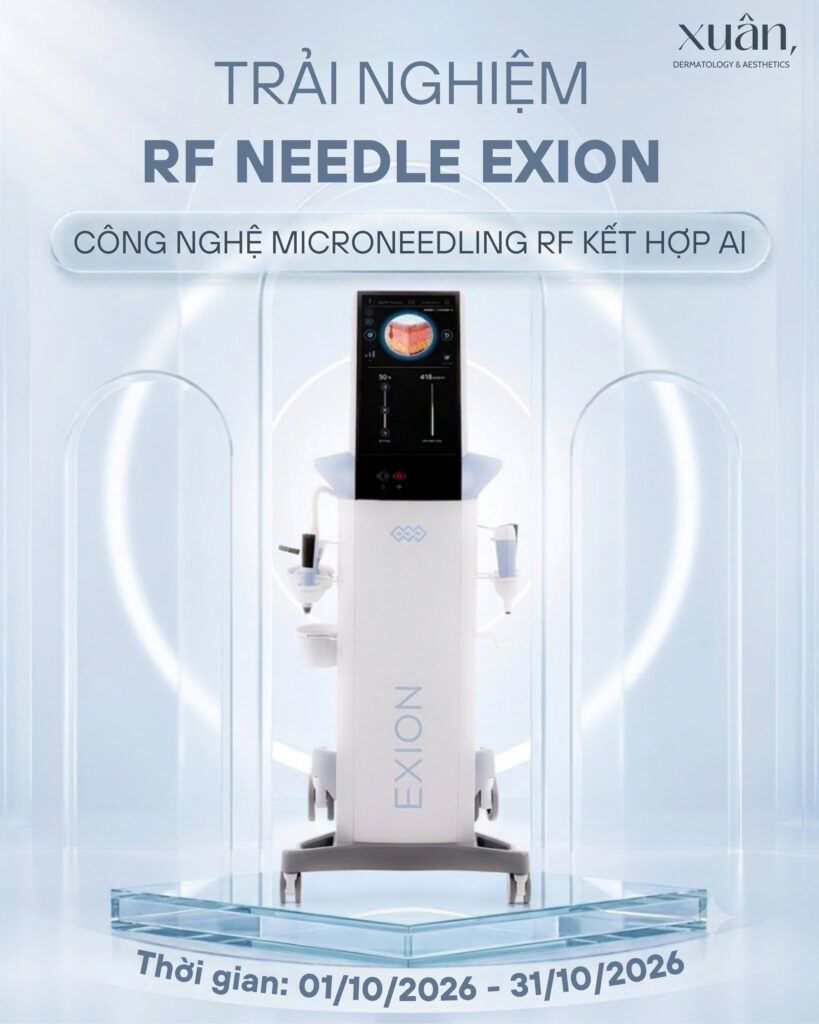 trải nghiệm máy RF needling trị sẹo