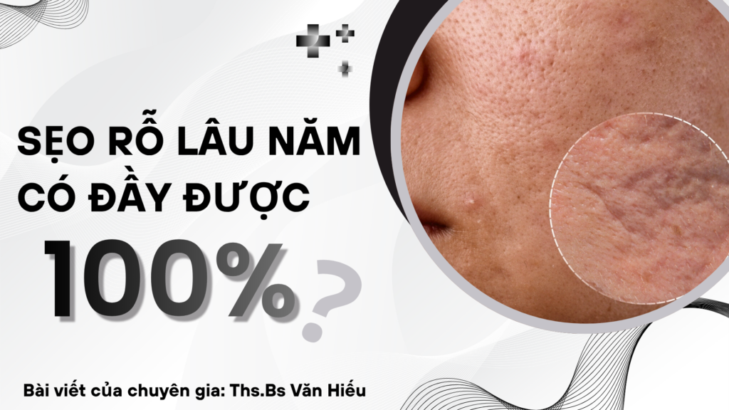 sẹo rỗ có đầy được không?