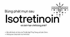 Bùng phát mụn sau isotretinoin